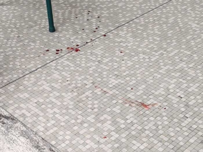 Aggressione ad Ascoli Piceno, la Questura acquisisce le immagini delle telecamere in zona